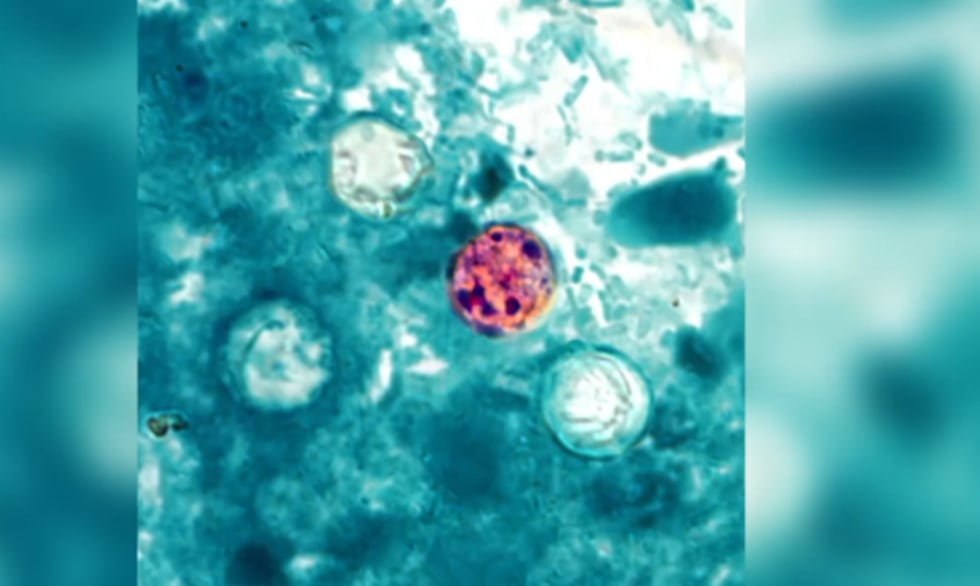 El parásito *Cyclospora*, que causa la ciclosporiasis.